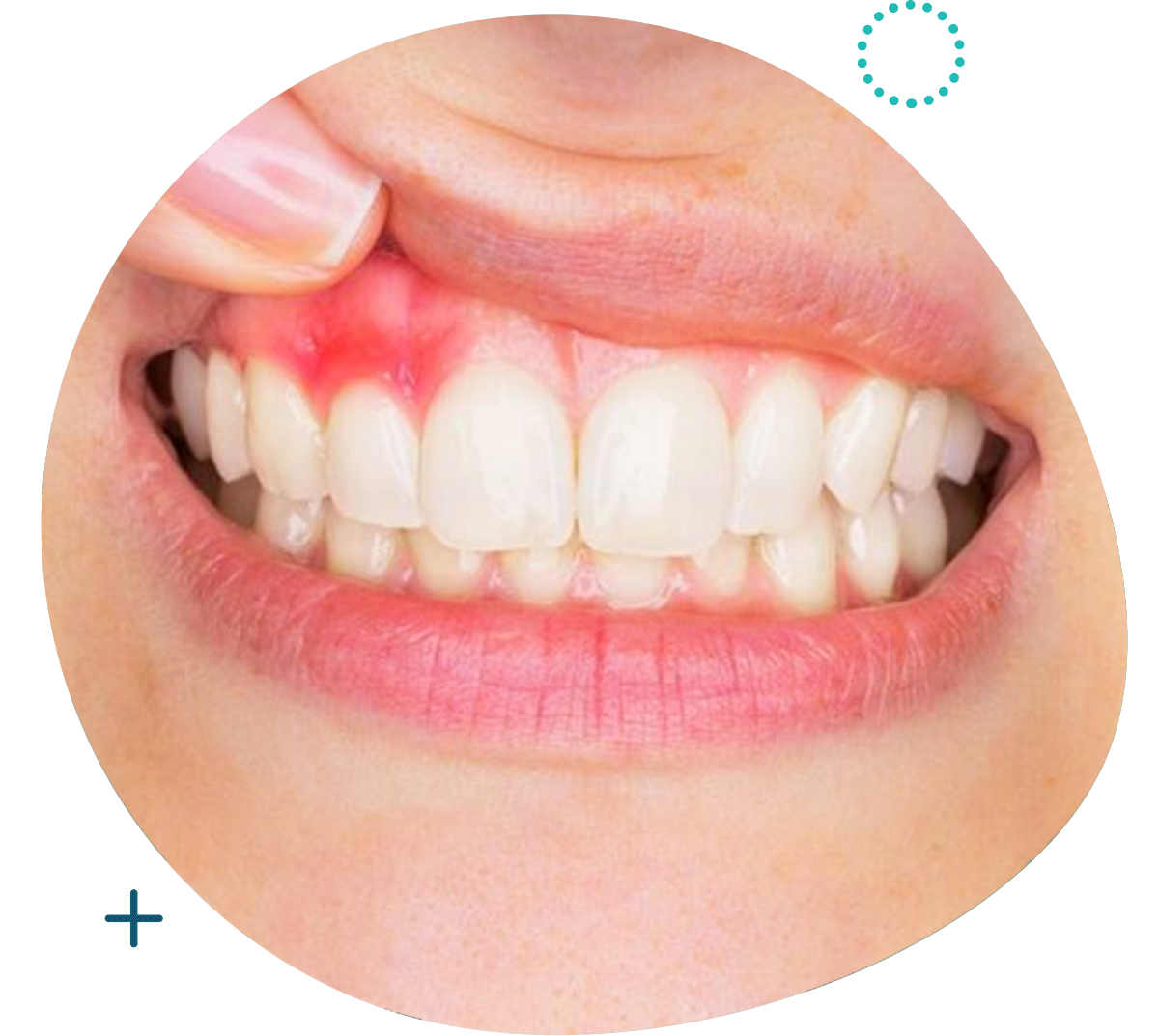 https://www.studiodentistico-pallotta-rossi.it/wp-content/uploads/2021/09/parodontologia.png